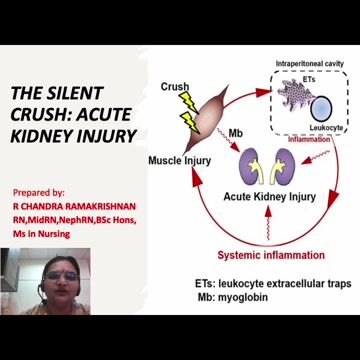 AKI (Acute Kidney Injury): The Silent Crash preview thumbnail